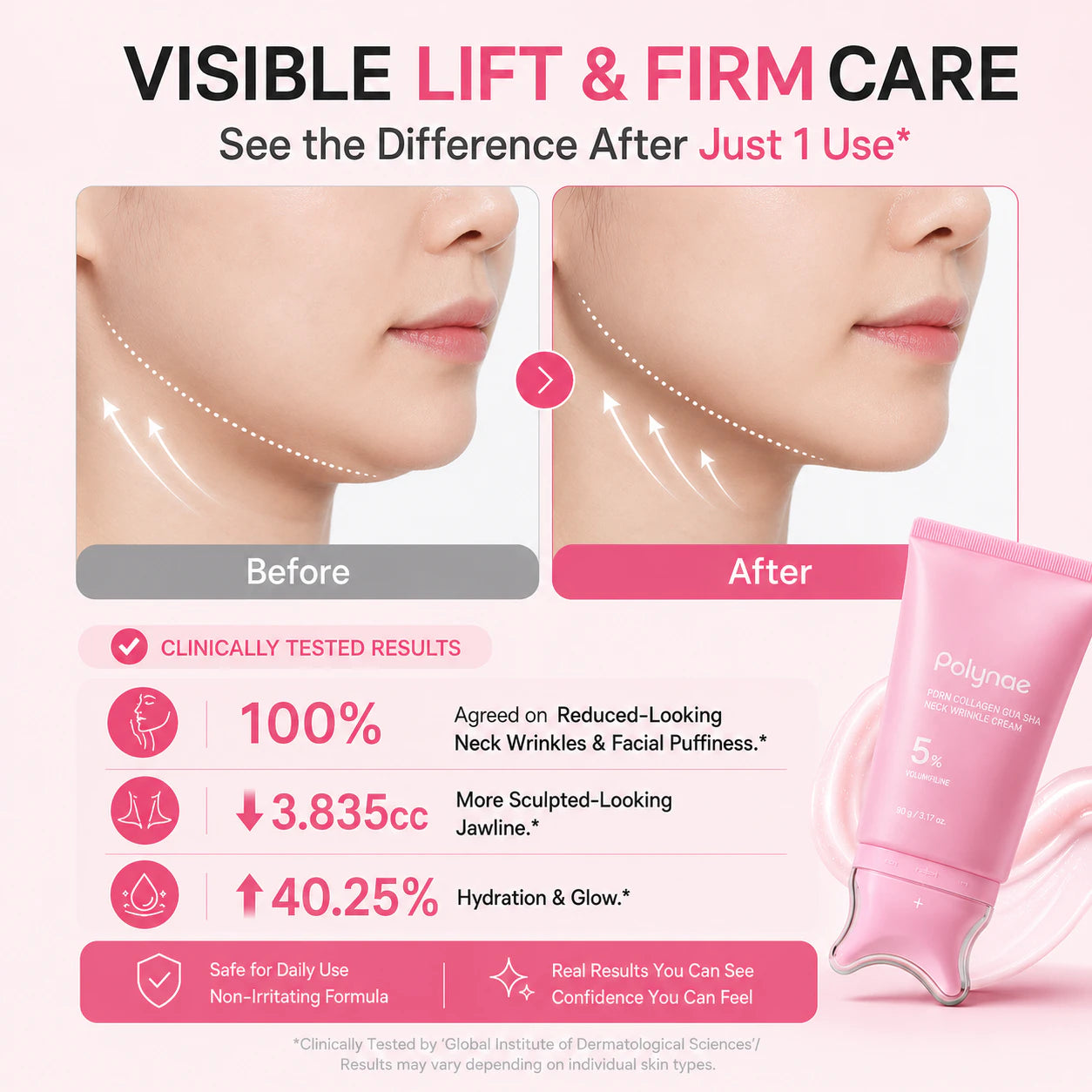 Before and after results showing a firmer-looking neck, sharper jawline, and smoother skin with Polynae neck cream.