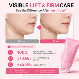 Before and after results showing a firmer-looking neck, sharper jawline, and smoother skin with Polynae neck cream.